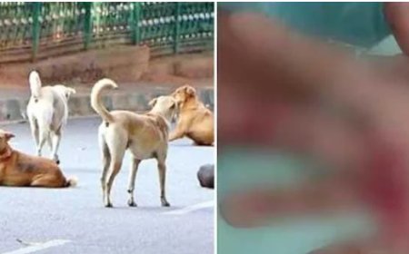 നാദാപുരത്ത് തെരുവുനായ ആക്രമണത്തിൽ രണ്ടു വയോധികമാർക്ക് പരിക്കേറ്റു