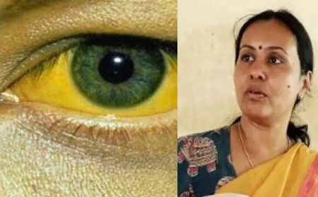 മഞ്ഞപ്പിത്തം മുതിര്‍ന്നവരില്‍ ഗുരുതരമാകാന്‍ സാധ്യതയേറെയെന്ന് വീണ ജോര്‍ജ്