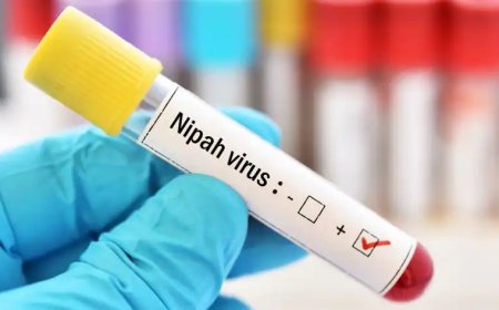 നിപ സംശയം:15കാരന്റെ നില ഗുരുതരം