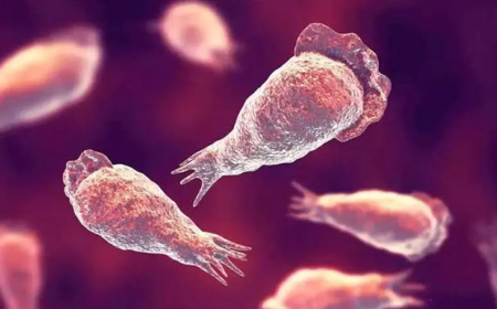 തിരുവനന്തപുരത്ത് യുവാവിന് അമീബിക്ക് മസ്തിഷ്ക ജ്വരമെന്ന് സംശയം: സാമ്പിൾ ഇന്ന് പരിശോധനക്ക് അയക്കും