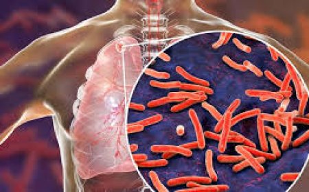 ആഗോള ടിബി നിവാരണ മാർഗങ്ങൾ കേരളത്തിലേക്ക്: സെമിനാറും ഡോക്യുമെന്റ് പ്രകാശനവും