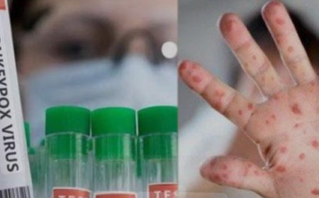 മലപ്പുറത്ത്  38 വയസ്സ്കാരന് എംപോക്സ്  രോഗം സ്ഥിരീകരിച്ചു