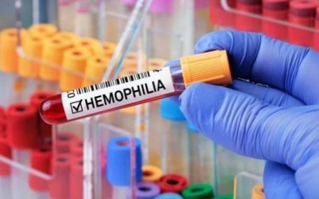 ഹീമോഫീലിയ ചികിത്സ സാധ്യമായ രീതിയില്‍ വികേന്ദ്രീകരിക്കും