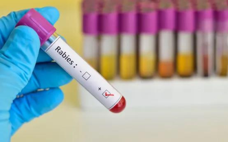 വാക്സീനെടുത്തിട്ടും ഏഴ് വയസുകാരിക്ക് പേവിഷബാധ; കുട്ടി തിരുവനന്തപുരം എസ്എടിയില് ചികിത്സയില്